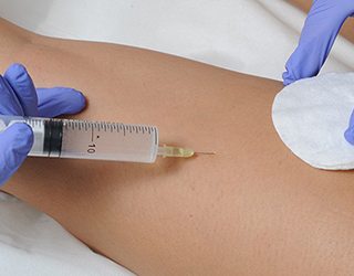 Mesoterapia